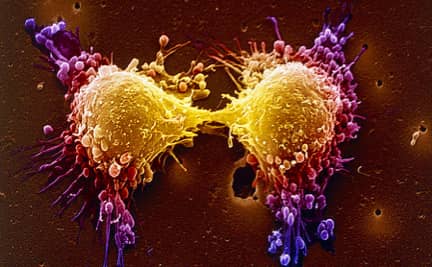 Cancer Cell Dividing